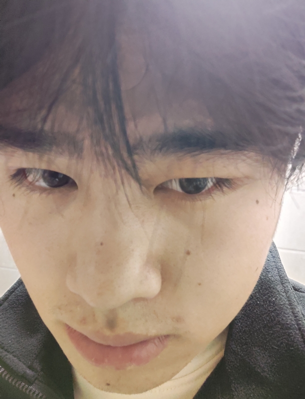 伤男的第一张照片--东山交友网